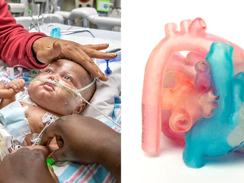 Congenital Heart Surgery Innovation: 3D Models in 2026