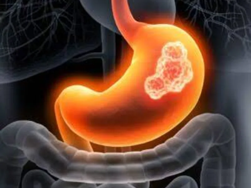 Digestive System Specialist in Kanpur