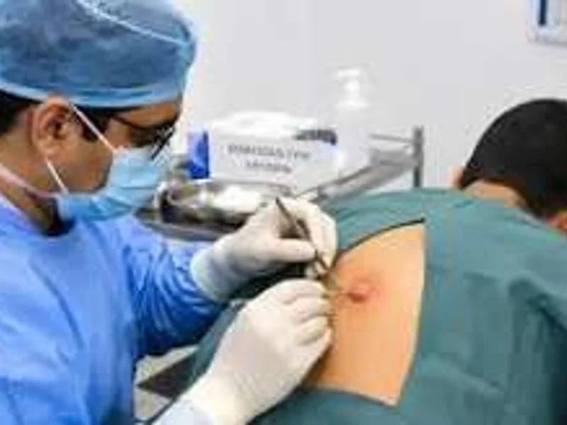 Surgery Consultation in Asansol: What to Expect