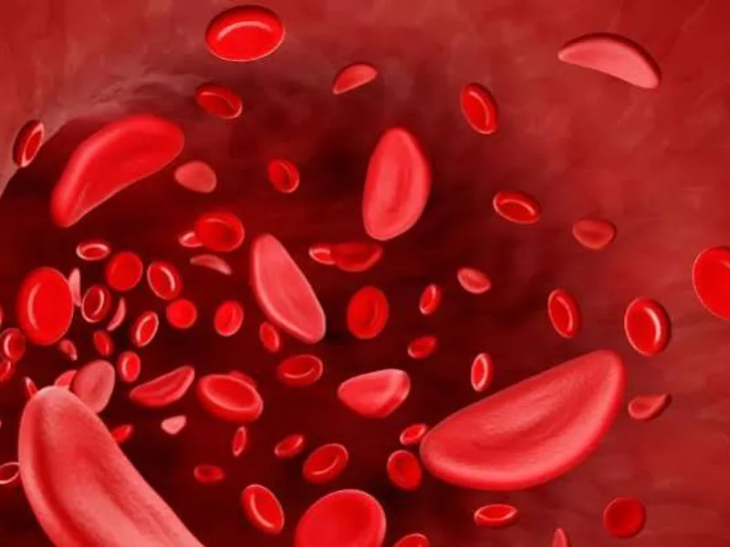 Sickle Cell Anaemia Screening in Bihar