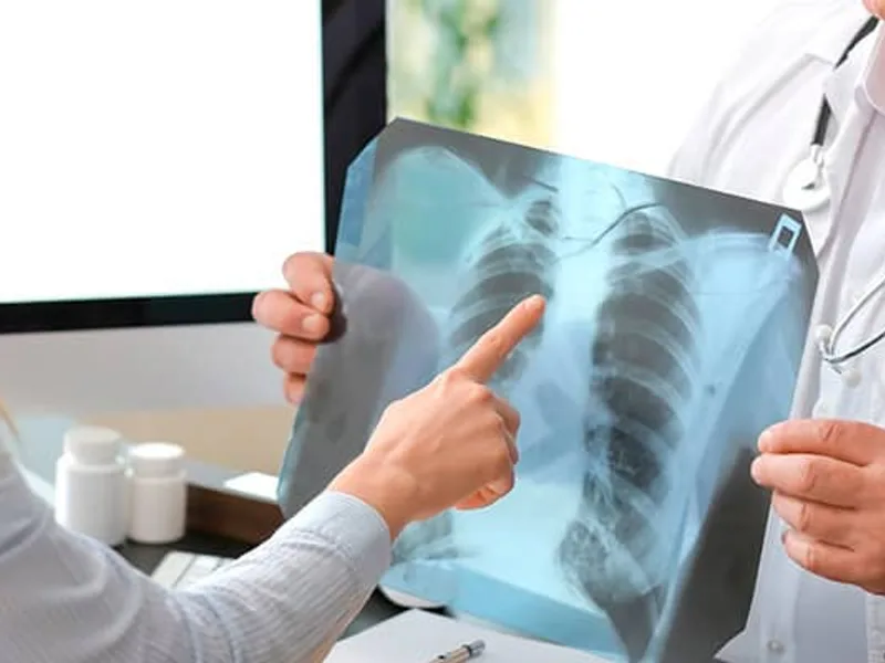 Best Pulmonologist in Kolkata