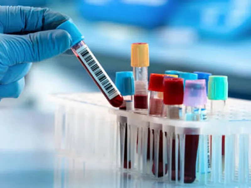 Rudhira Diagnostics: Ahilyanagar's Trusted Pathology Lab, Blood Test & Diagnostics Centre