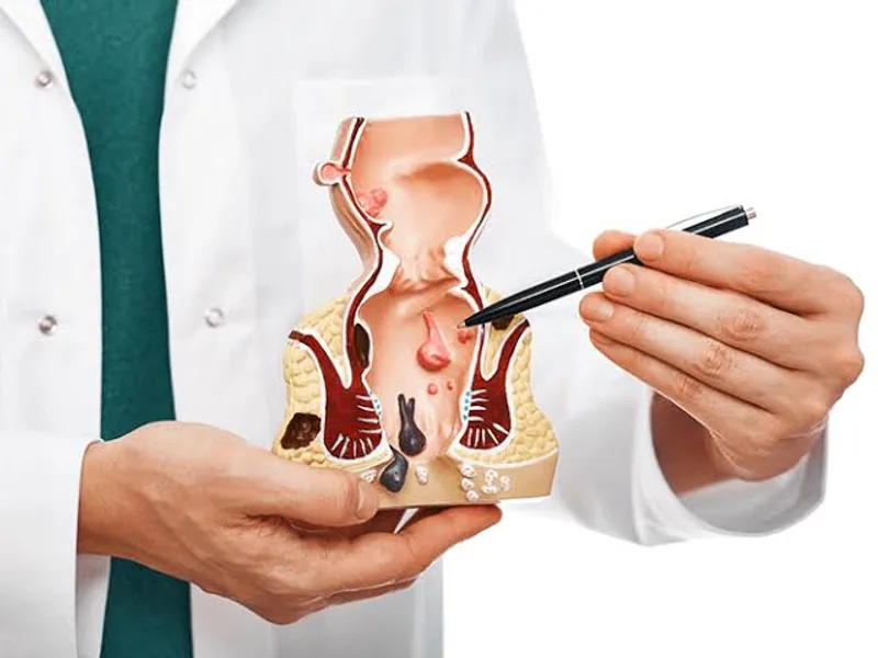 Piles Laser Surgery Cost and Insurance in India