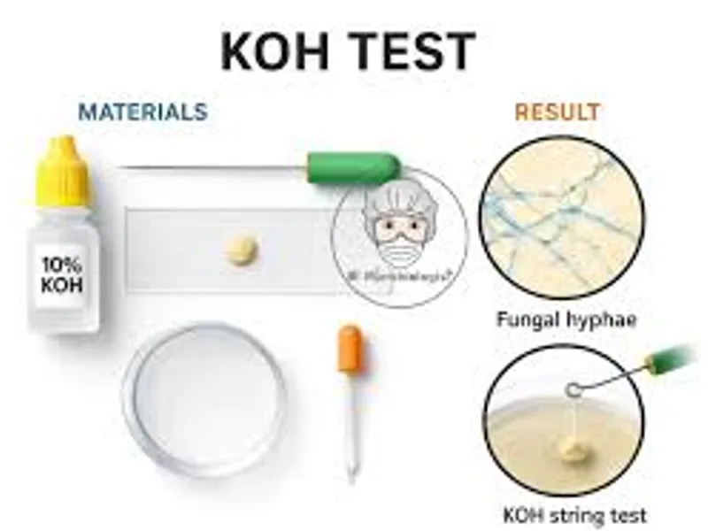 KOH Prep: A Quick Test for Fungal Infections