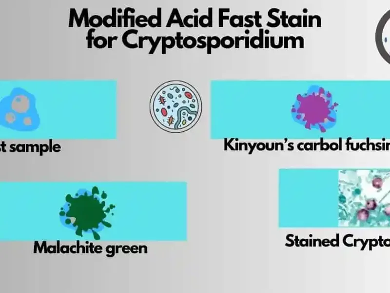 Modified Acid-Fast Stain: Uncovering Hidden Causes of Diarrhea