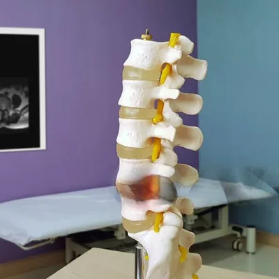 Dr. Asit Spine Surgeon