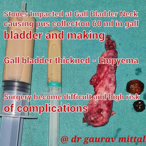 Dr. Gaurav Mittal