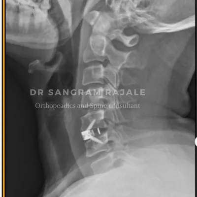 Dr. Sangram Kapale
