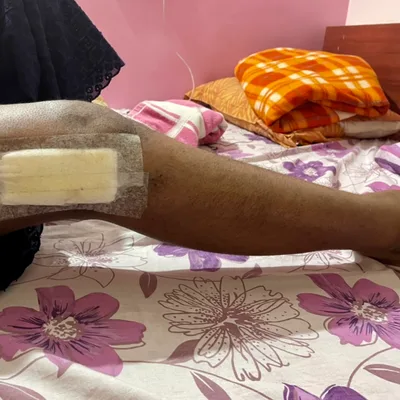 Dr. Tejas Rathod Physiotherapist