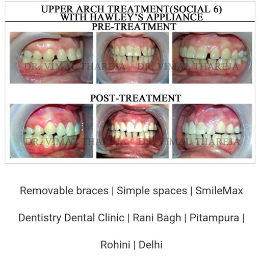 Dr. Vimal Thareja