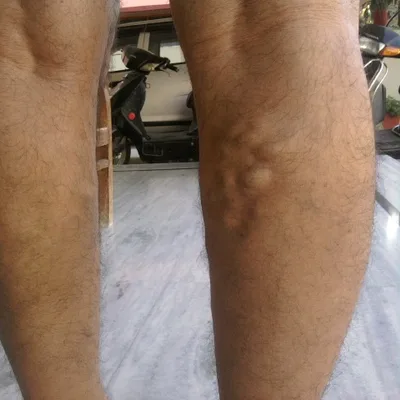 Dr. Pradeep Kumar Muley