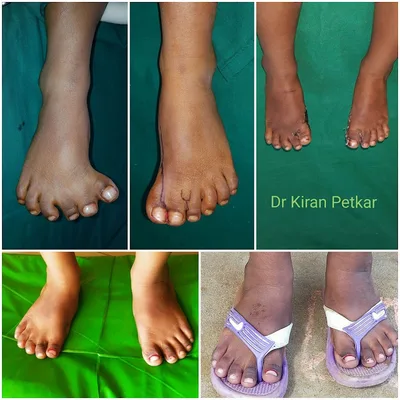 Dr. Kiran Petkar