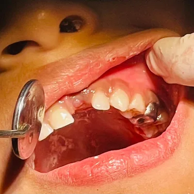 Dr. Revathi Natesan