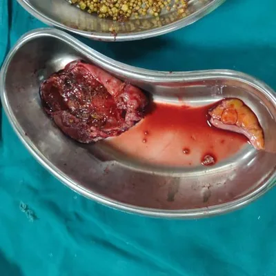 Dr. Ramachandraiah Doctor