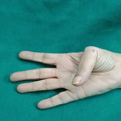 Dr. KV.Shah Doctor