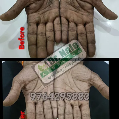 Dr. SAGAR S. NALE