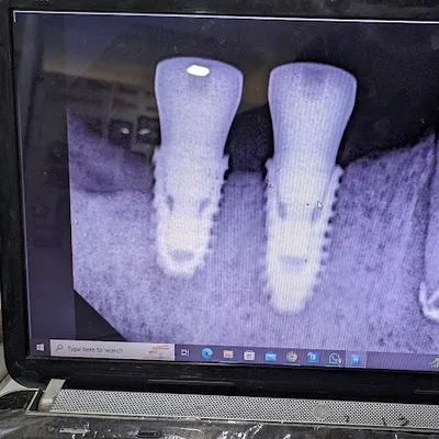 Dr. Sparsh Multispeciality Dental Care