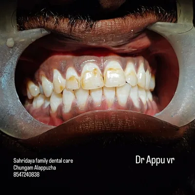 Dr. Appu vr's SAHRIDAYA FAMILY DENTAL CARE