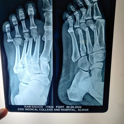 Dr. Mohit Agarwal (Bone & Joint OPD)