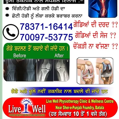 Dr. HP SINGH Joint Replacement Surgeon