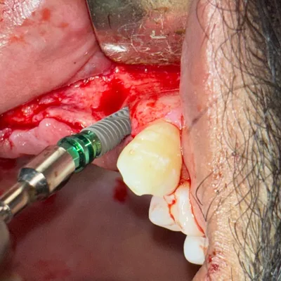 Dr. Dhawan's Nu-Face Dental Clinic
