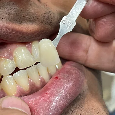 Dr. KOHLI MULTISPECIALITY DENTAL & TRAUMA CARE CENTRE