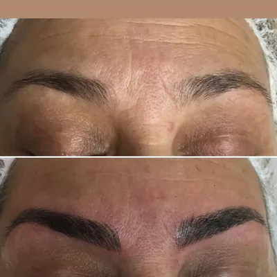 Dr. R.K.Sokhi,s DERMA WORLD