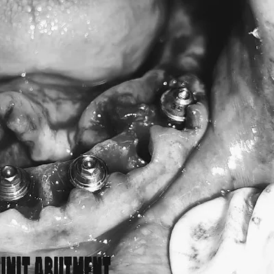 Dr. Minesh Patel's 32 Dental Care