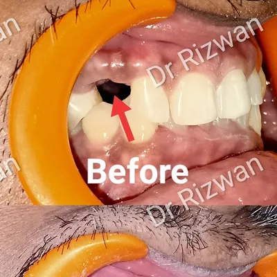 Dr. Rizwan Shaikh Family dental care