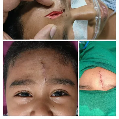 Dr. Ritabrata Mukhopadhyay : Plastic Surgeon and Trauma Reconstruction in South Kolkata