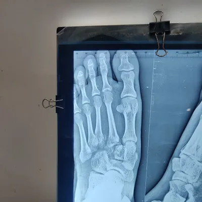 Dr. Sumit Jain Orthopedic Surgeon