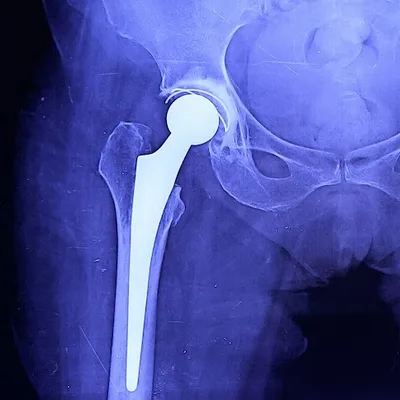 Dr. Debasish Naskar- Knee replacement surgeon