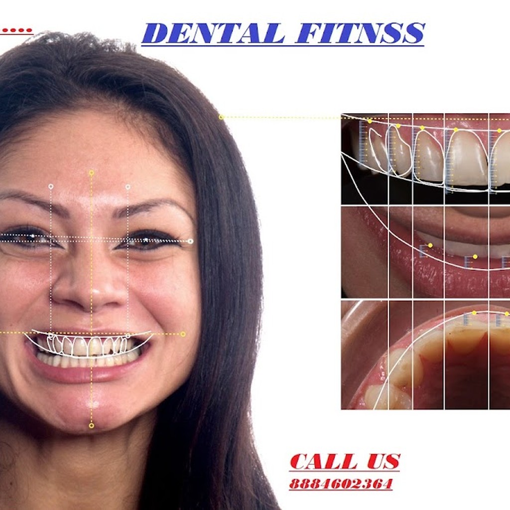 Dental Fitness