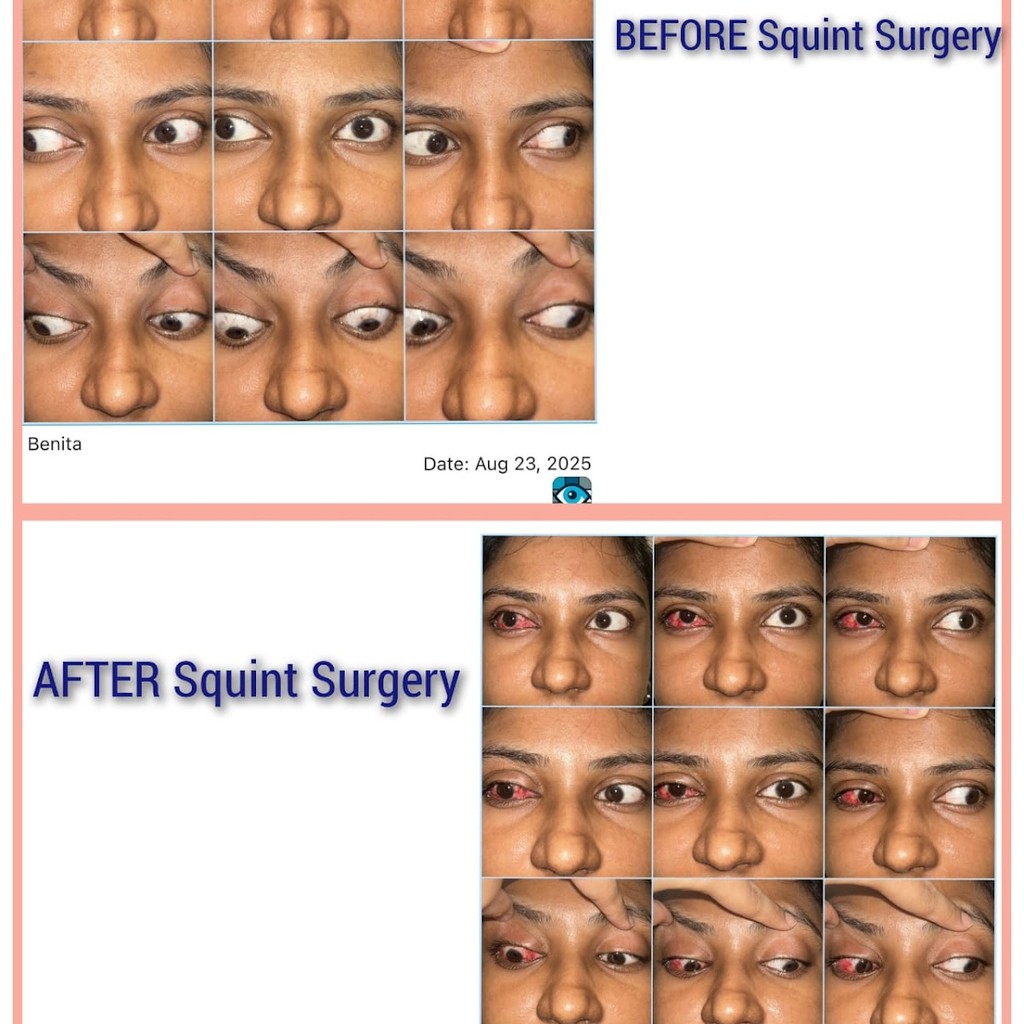 DR AGARWAL EYE HOSPITAL - CEDS