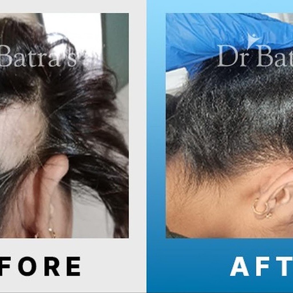 Dr Batra's Positive Health Clinic Pvt Ltd