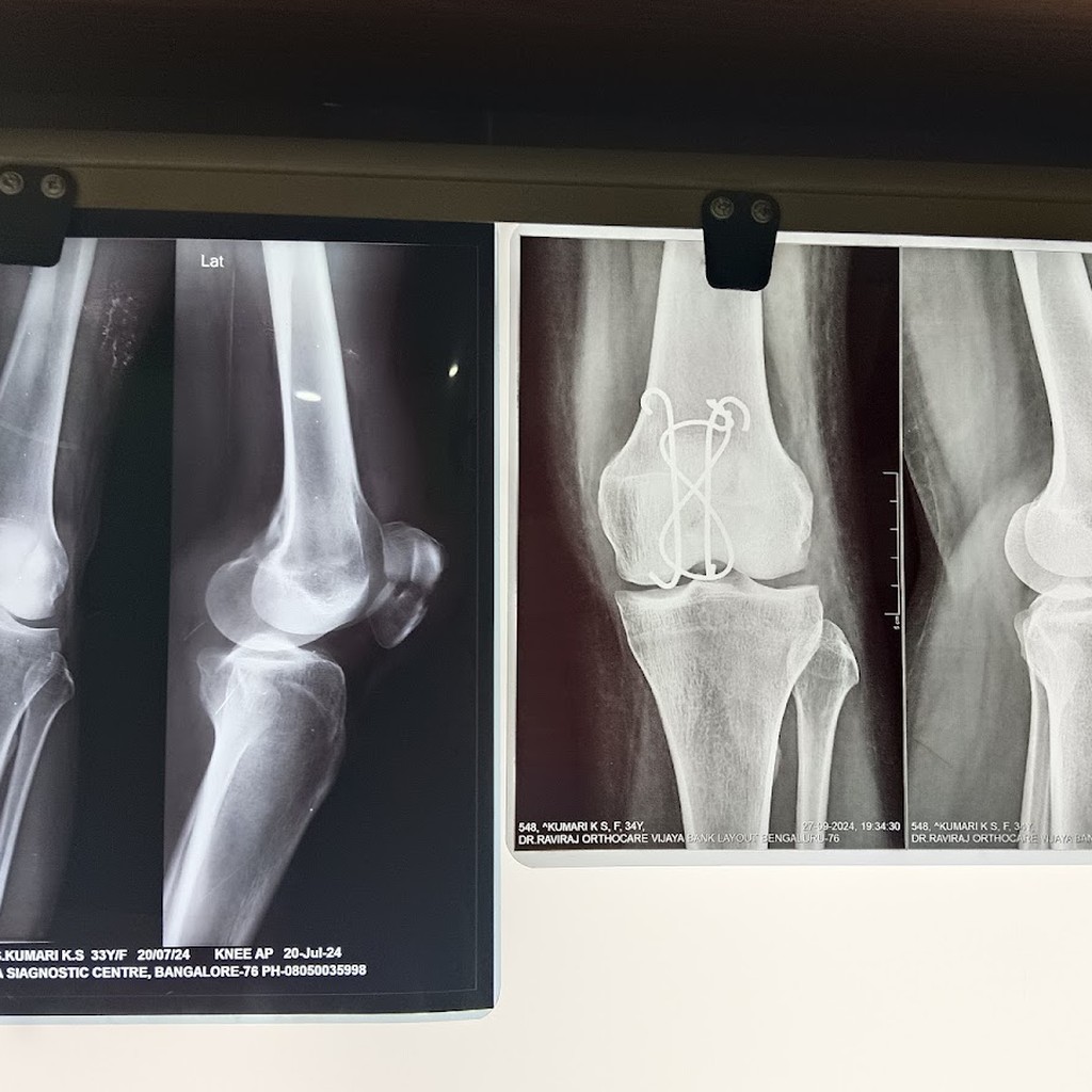 Dr RaviRaj OrthoCare
