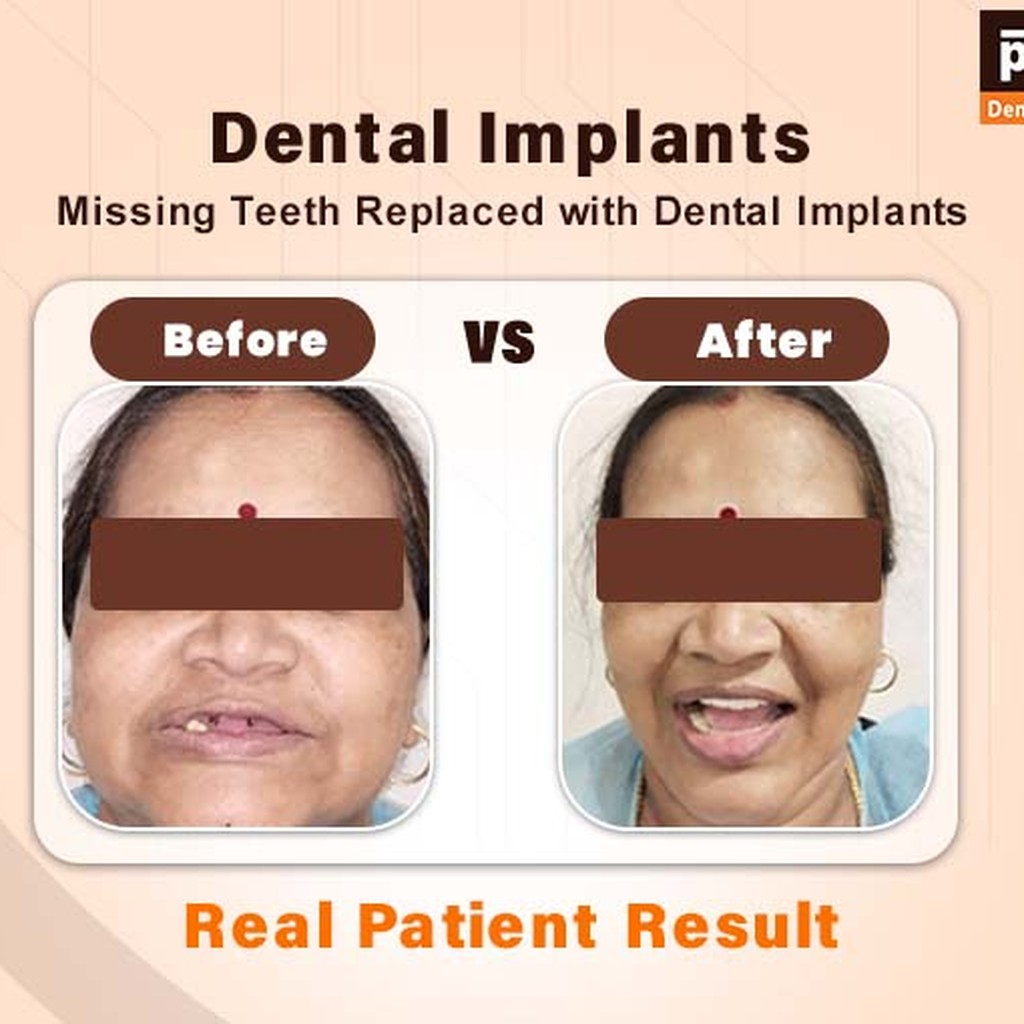 Partha Dental Skin Hair