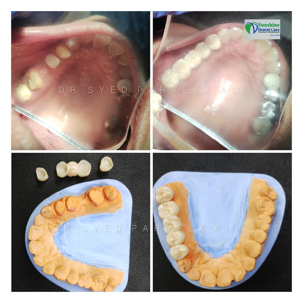 Sunshine Dental Care