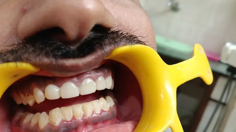 Manish Dental Hospital