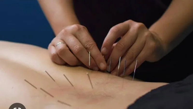 NP PHYSIOTHERAPY