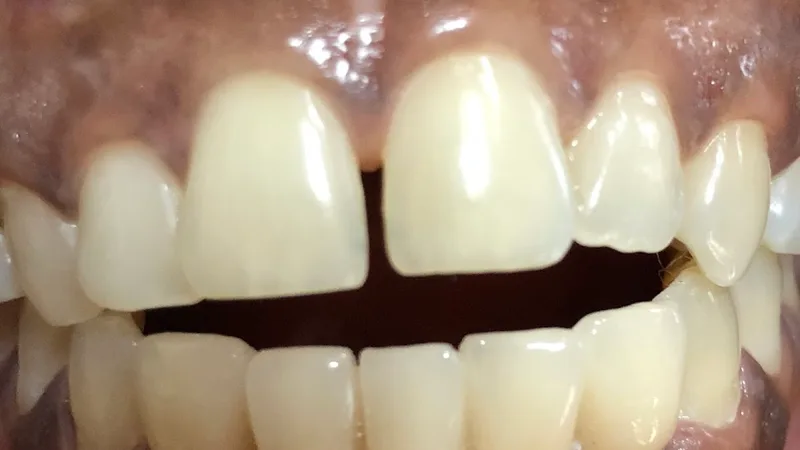 Sri Sai Indira Dental Hospital