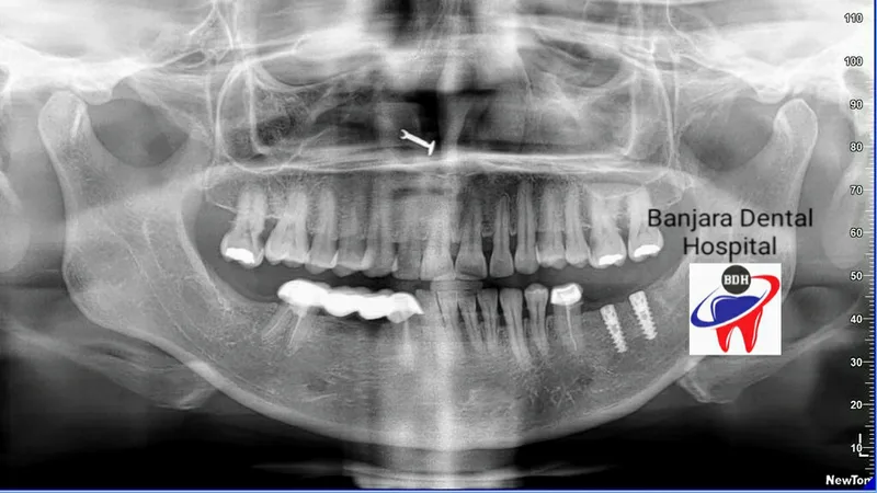 Banjara Dental Hospital