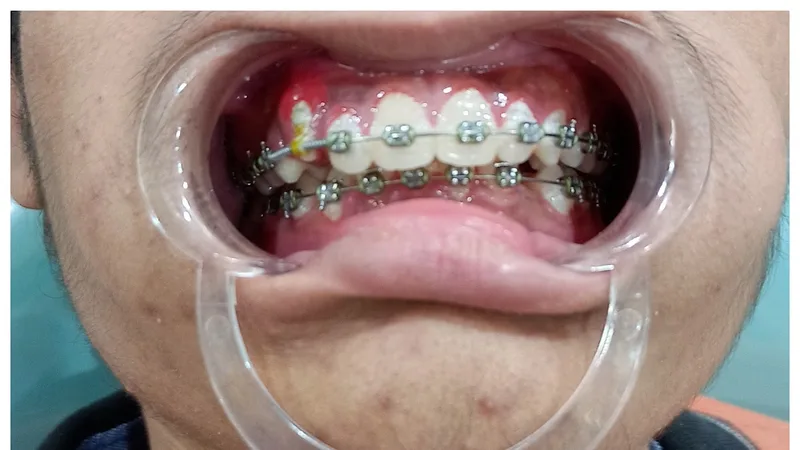 Global Multi Speciality Dental Hospital
