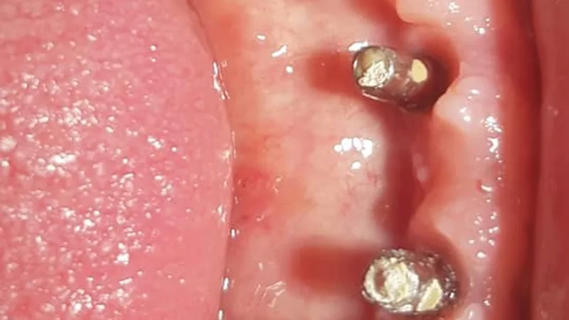 Geeta Dental Hospital and Implant Centre