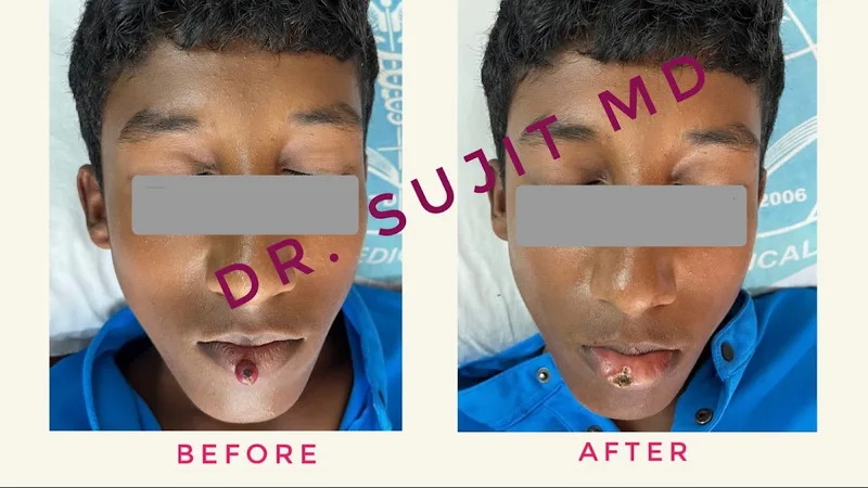 Zen Skin Haven, Dr. Sujit Debbarma, MD.Dermatologist, Skin Hair Laser Clinic
