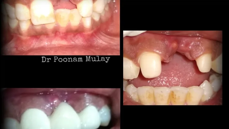 Smruti Dental Care & Facial Surgical Centre