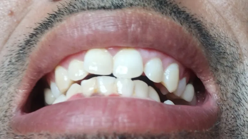 Maxdent Multi Speciality Dental Clinic