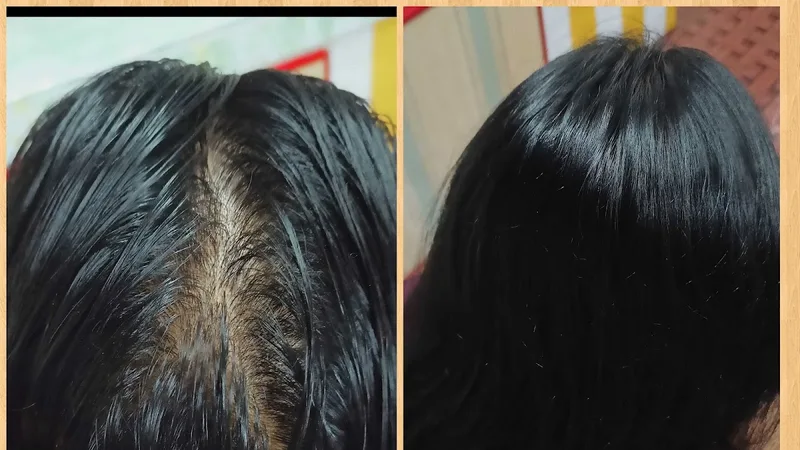 SERRAVIA SKIN CLINIC AND HAIR CLINIC-best skin clinic and hair clinic in alappuzha