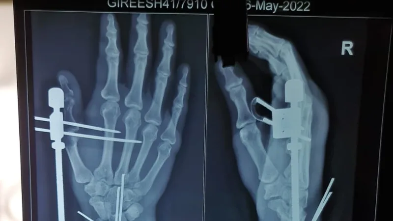 Orthopedic surgeon - doctor