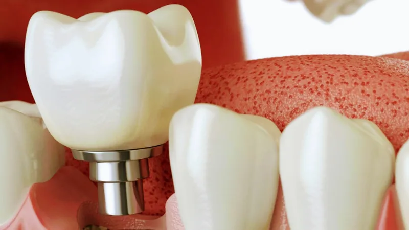 ROME DENTAL CARE & IMPLANT CENTER-1